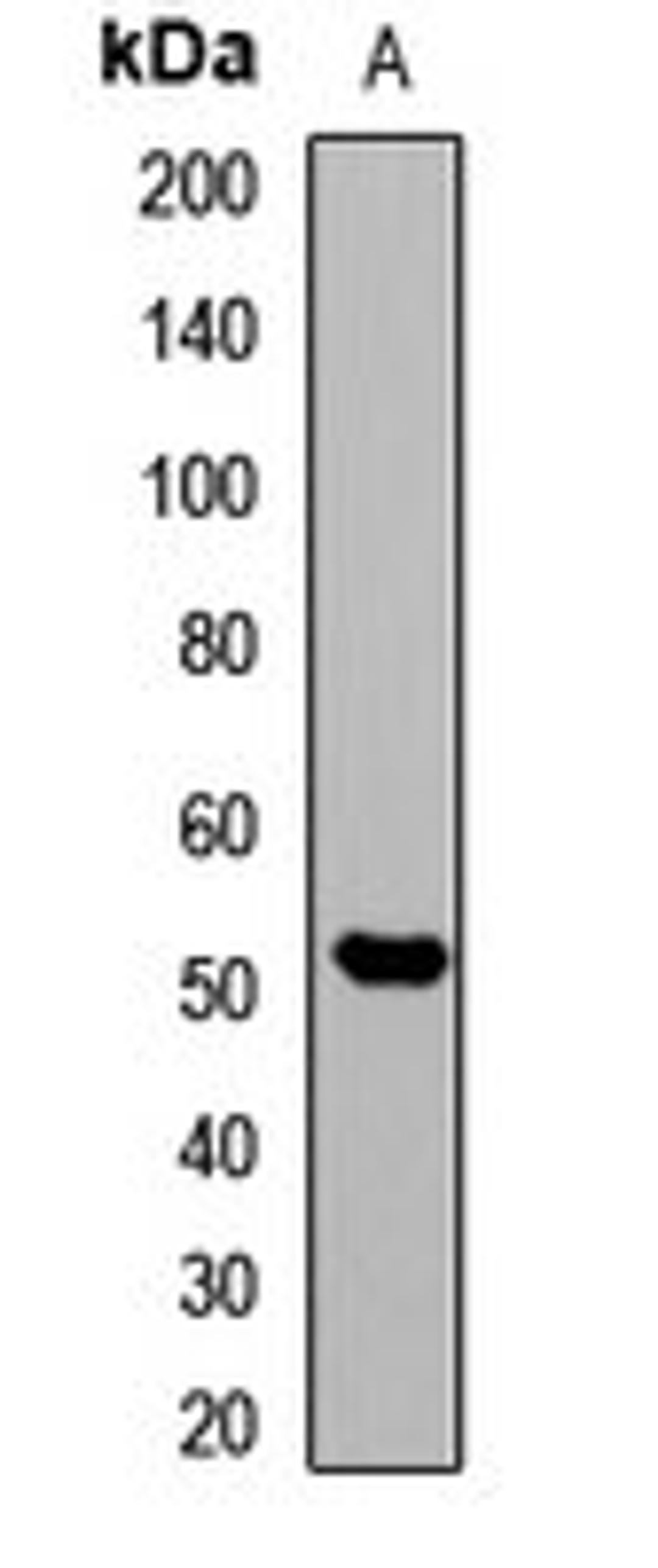 Western blot analysis of Hela (Lane1) whole cell lysates using pan methyl-lysine antibody