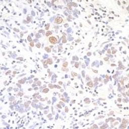 Detection of human API5 by immunohistochemistry.