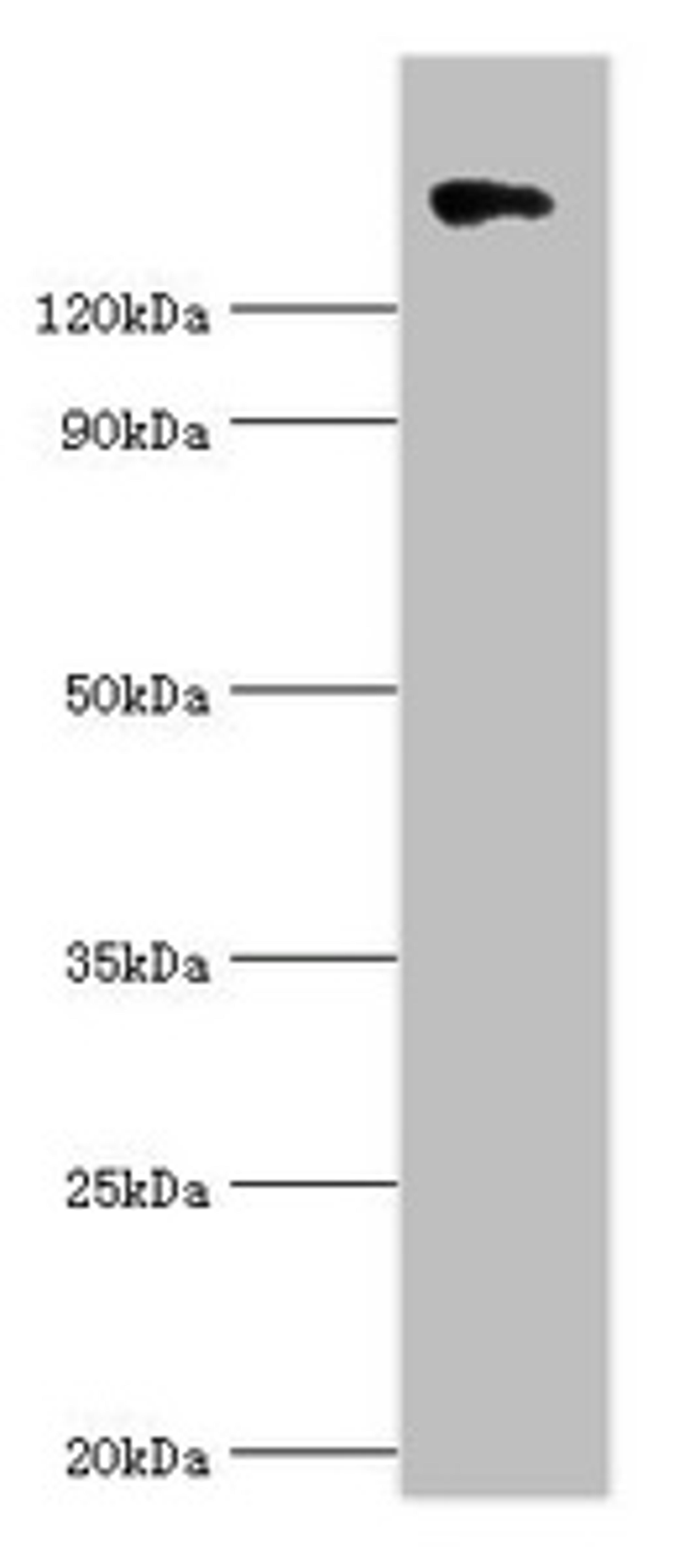 Western blot. All lanes: Collagen alpha-1 (II) chain antibody at 10ug/ml + 293T whole cell lysate. Secondary. Goat polyclonal to rabbit IgG at 1/10000 dilution. Predicted band size: 142, 135, 30 kDa. Observed band size: 142 kDa. 