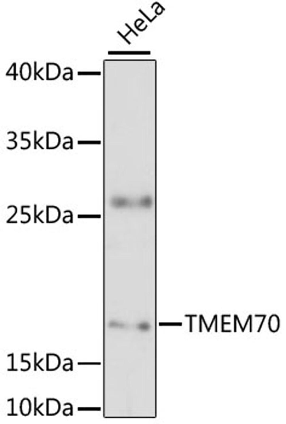 Western blot - TMEM70 antibody (A13712)