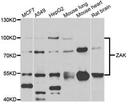 Western blot analysis of extracts of various cell lines using ZAK antibody