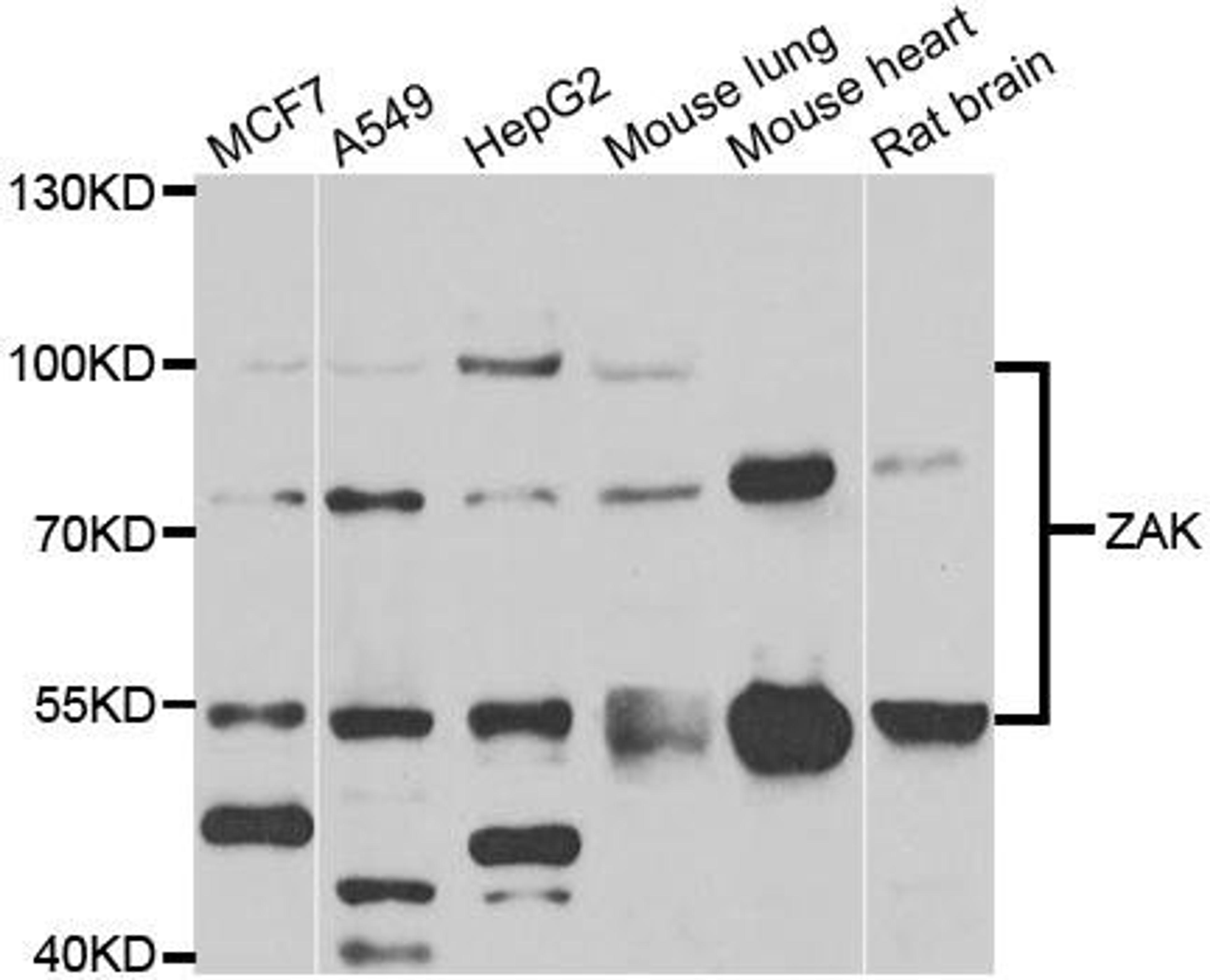 Western blot analysis of extracts of various cell lines using ZAK antibody