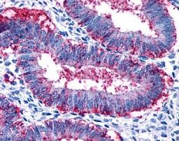 Immunohistochemistry: Relaxin R2/LGR8 Antibody [NLS4753] - Analysis of anti-RXFP2 / LGR8 antibody with human uterus.