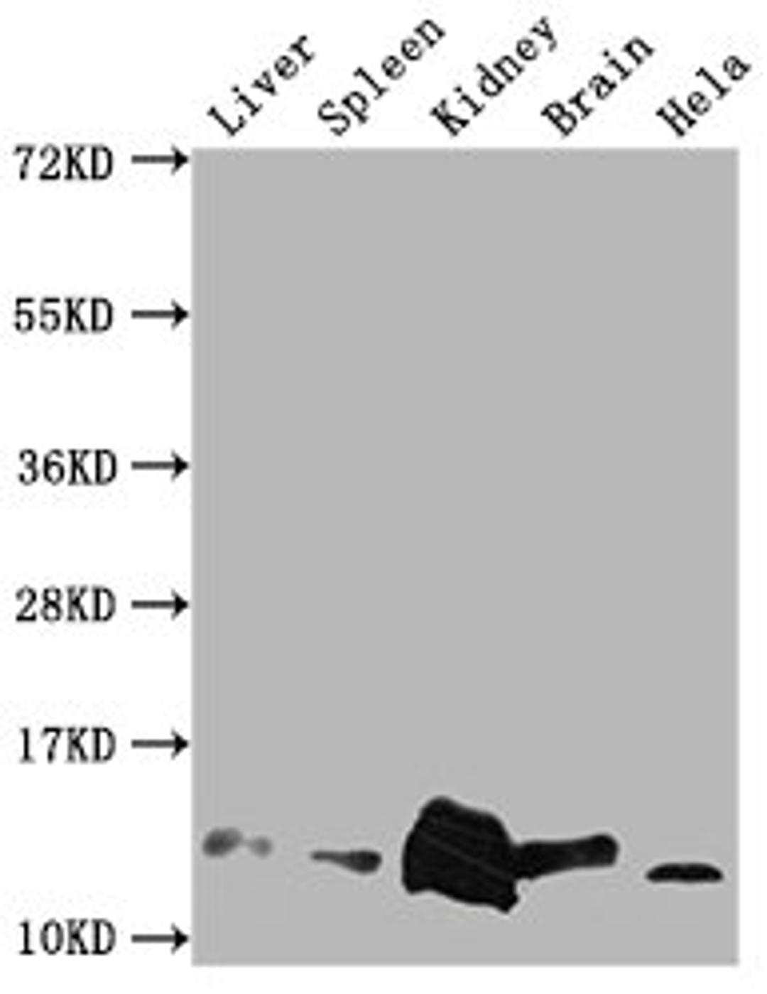 Western Blot. Positive WB detected in: Mouse Liver tissue, Mouse Spleen tissue, Mouse kidney tissue, Mouse Brain tissue, Hela whole cell lysate. All lanes: Mif antibody at 1:2000. Secondary. Goat polyclonal to rabbit IgG at 1/50000 dilution. Predicted band size: 13 kDa. Observed band size: 13 kDa. 