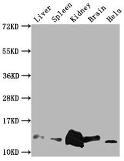 Western Blot. Positive WB detected in: Mouse Liver tissue, Mouse Spleen tissue, Mouse kidney tissue, Mouse Brain tissue, Hela whole cell lysate. All lanes: Mif antibody at 1:2000. Secondary. Goat polyclonal to rabbit IgG at 1/50000 dilution. Predicted band size: 13 kDa. Observed band size: 13 kDa. 
