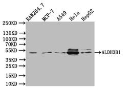 Western Blot. Positive WB detected in: K562 whole cell lysate, Rat kidney tissue, Rat spleen tissue, Mouse stomach tissue. All lanes: ALDH3B1 antibody at 3µg/ml. Secondary. Goat polyclonal to rabbit IgG at 1/50000 dilution. Predicted band size: 52, 48 kDa. Observed band size: 52 kDa