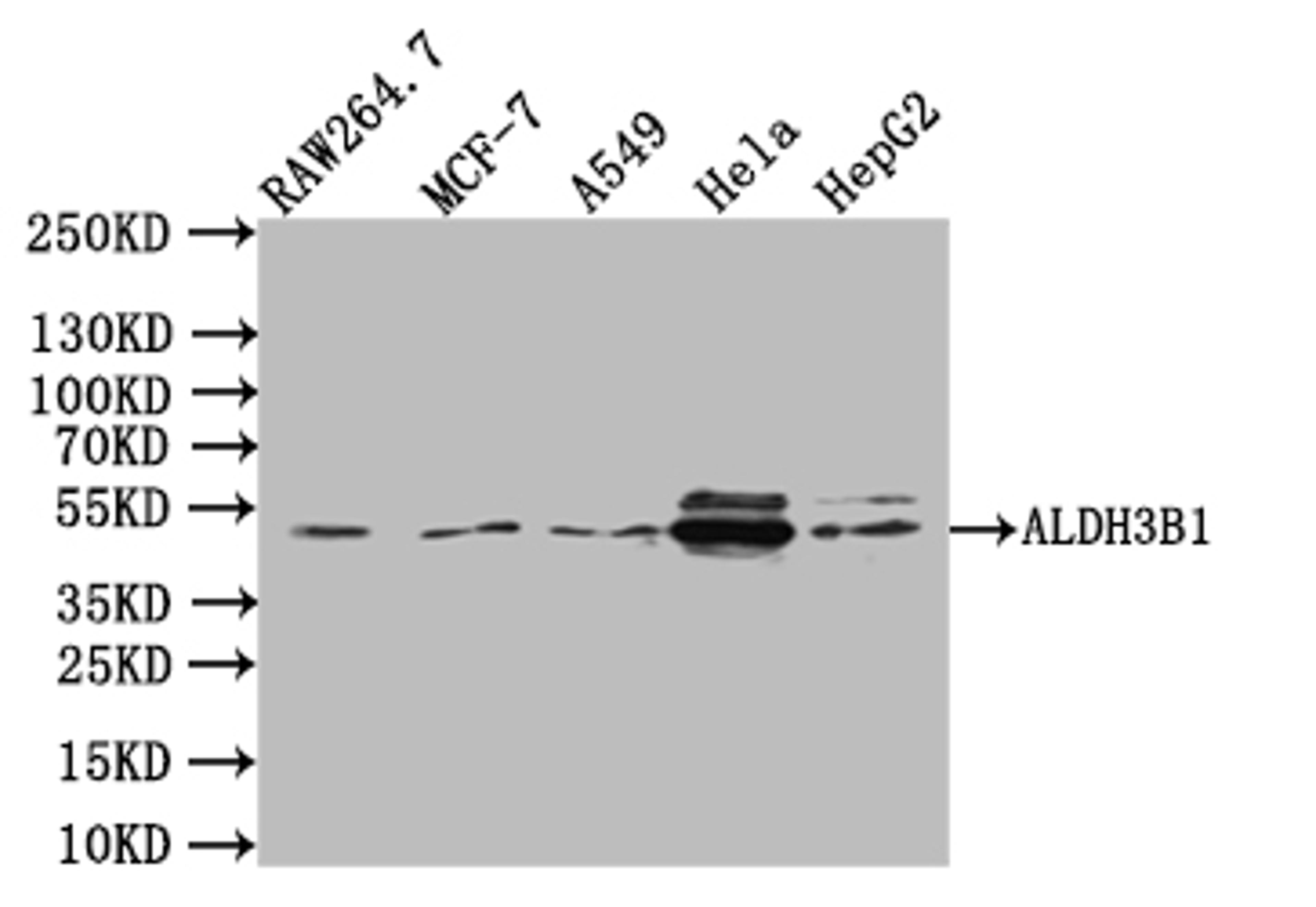 Western Blot. Positive WB detected in: K562 whole cell lysate, Rat kidney tissue, Rat spleen tissue, Mouse stomach tissue. All lanes: ALDH3B1 antibody at 3µg/ml. Secondary. Goat polyclonal to rabbit IgG at 1/50000 dilution. Predicted band size: 52, 48 kDa. Observed band size: 52 kDa
