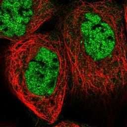 Immunocytochemistry/Immunofluorescence: CAPN14 Antibody [NBP1-90911] - Staining of human cell line A-431 shows positivity in nucleus but not nucleoli.