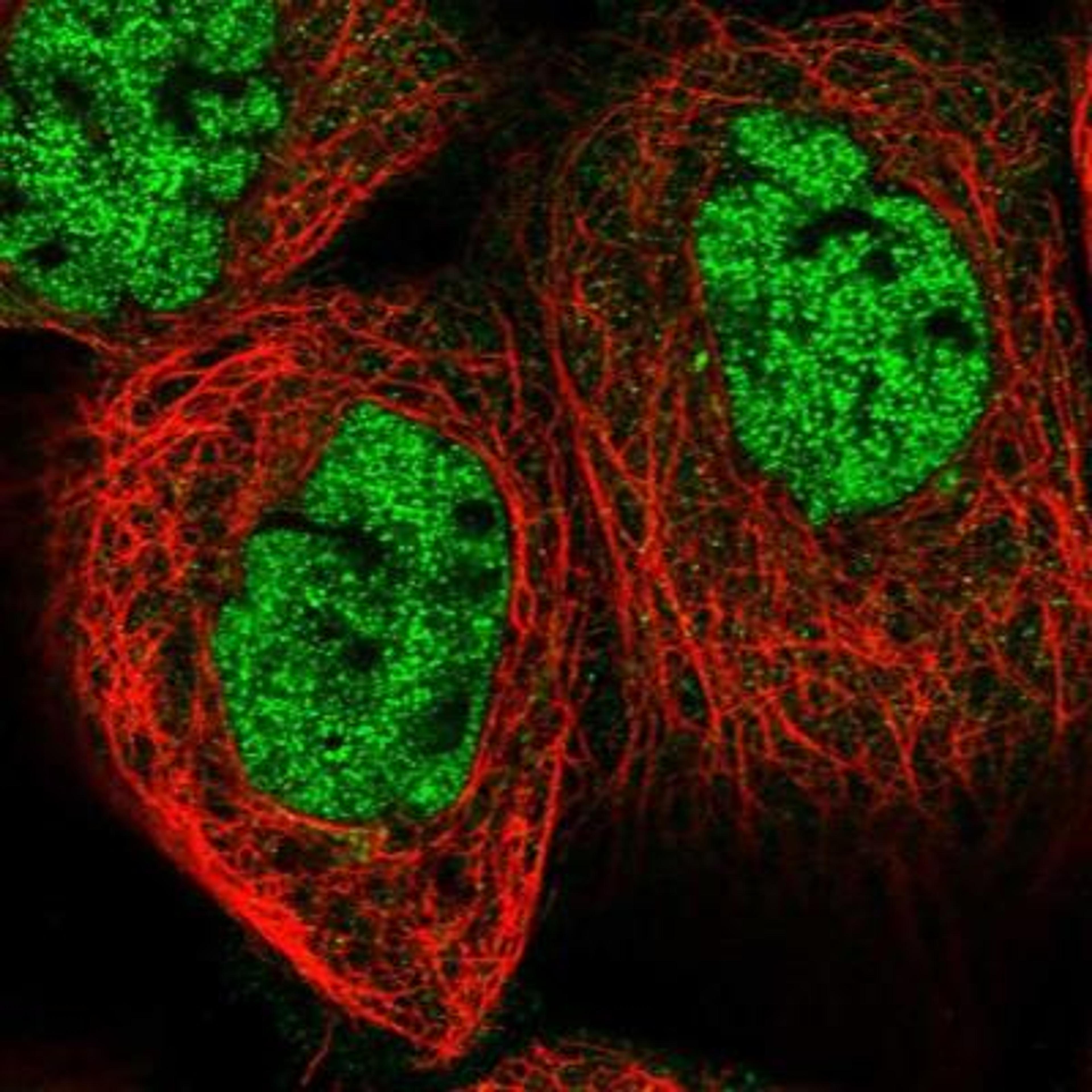 Immunocytochemistry/Immunofluorescence: CAPN14 Antibody [NBP1-90911] - Staining of human cell line A-431 shows positivity in nucleus but not nucleoli.