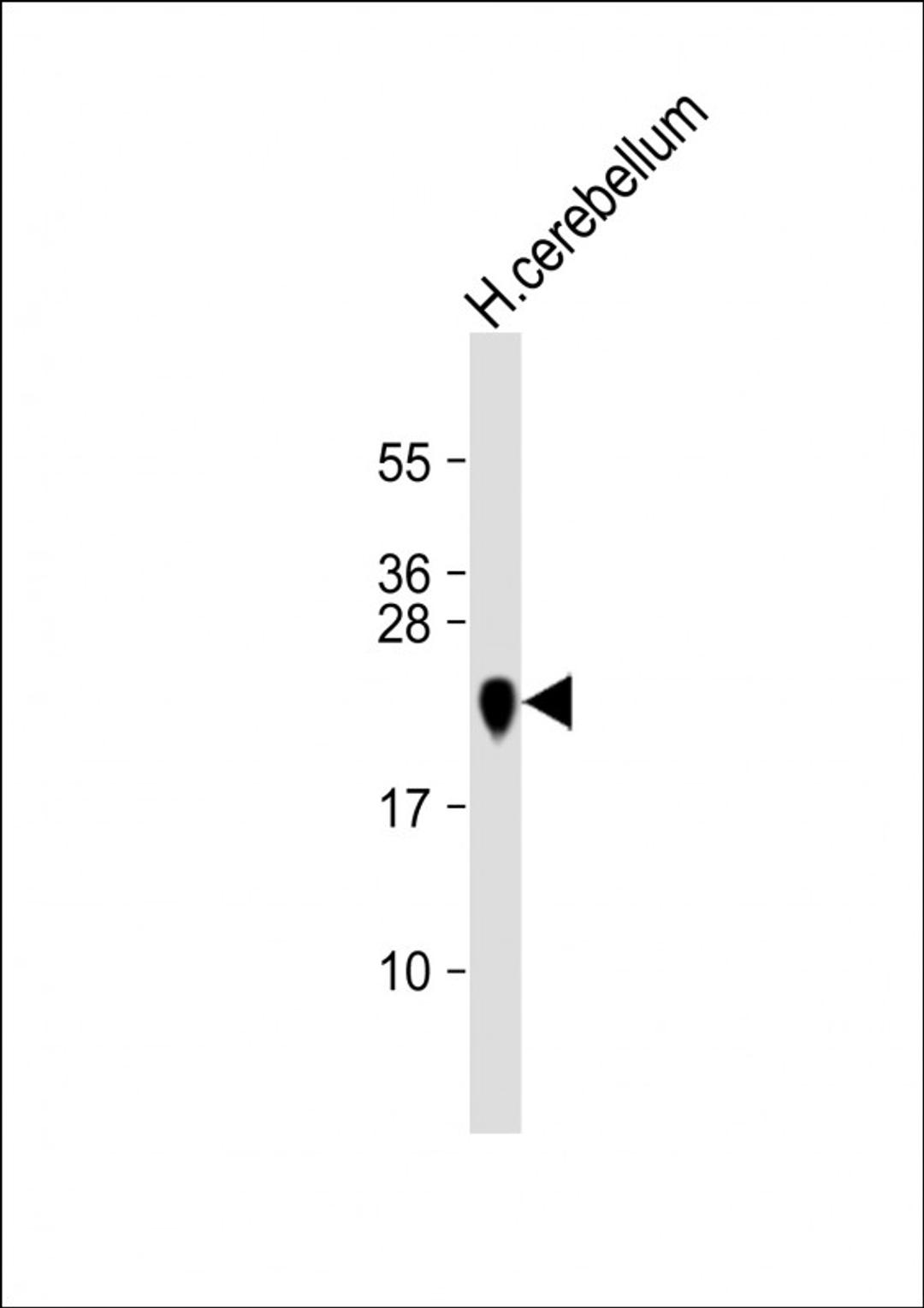 Western Blot at 1:16000 dilution + human cerebellum lysate Lysates/proteins at 20 ug per lane.