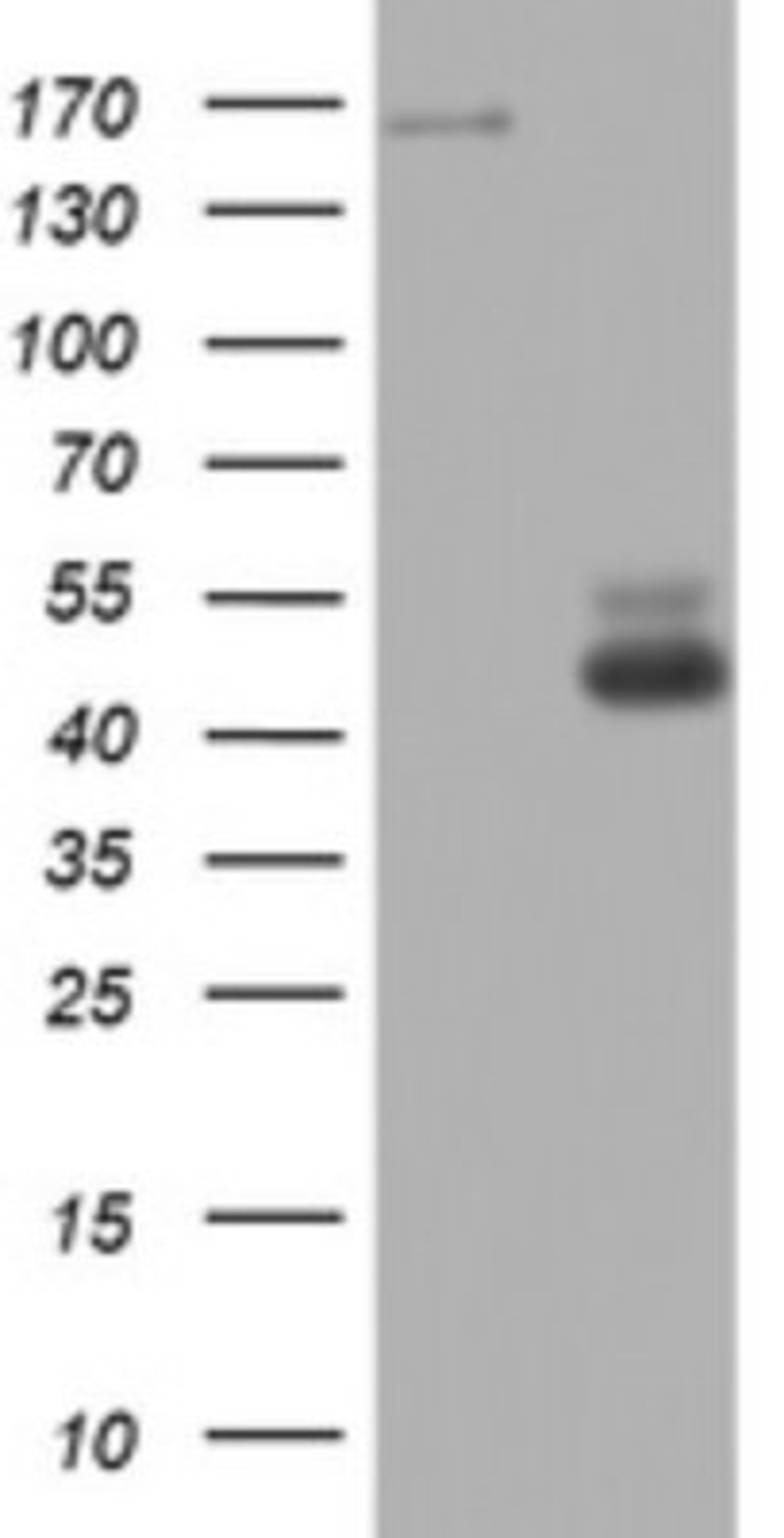 Western Blot: TOP2A Antibody (2A9) [NBP2-46184] - Analysis of HEK293T cells were transfected with the pCMV6-ENTRY control (Left lane) or pCMV6-ENTRY TOP2A.