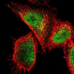 Immunocytochemistry/Immunofluorescence: CDC2L6 Antibody [NBP1-90034] - Staining of human cell line U-251MG shows positivity in nucleus but not nucleoli & vesicles.