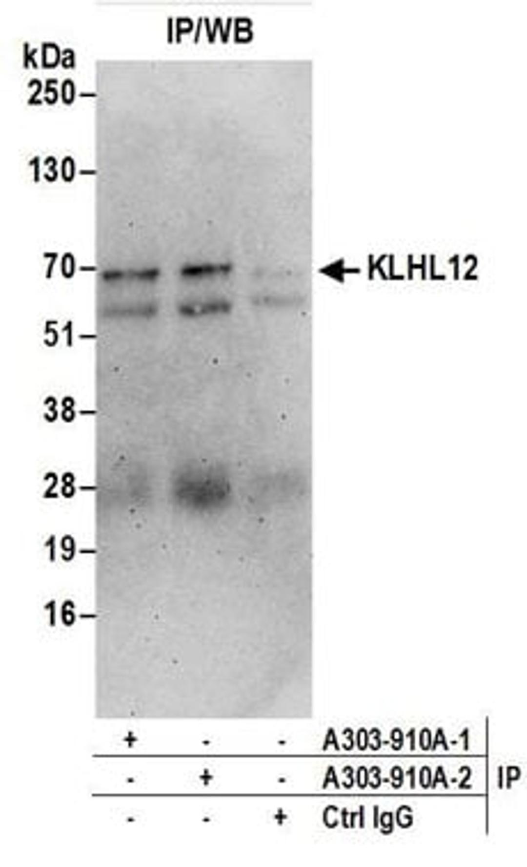 Detection of human KLHL12 by western blot of immunoprecipitates.