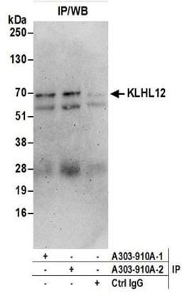 Detection of human KLHL12 by western blot of immunoprecipitates.