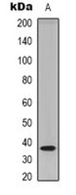 Western blot analysis of HEK293T (Lane 1) whole cell lysates using TECR antibody