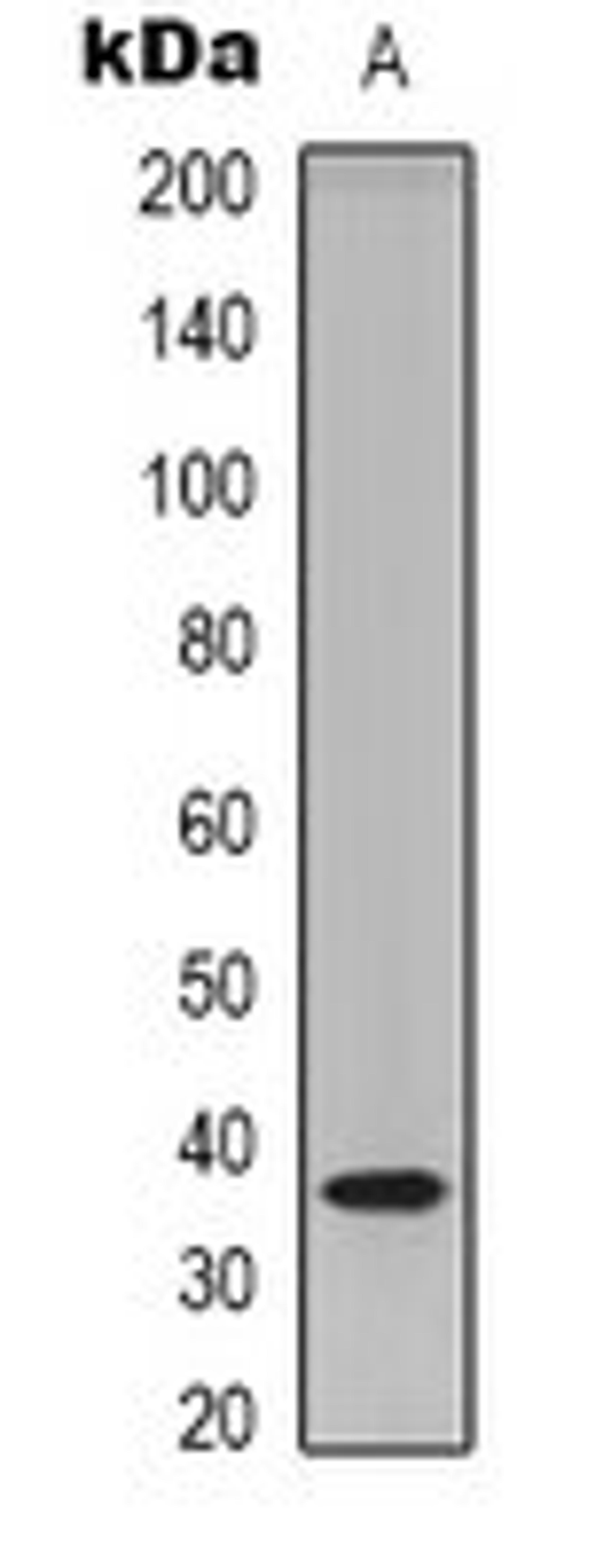 Western blot analysis of HEK293T (Lane 1) whole cell lysates using TECR antibody