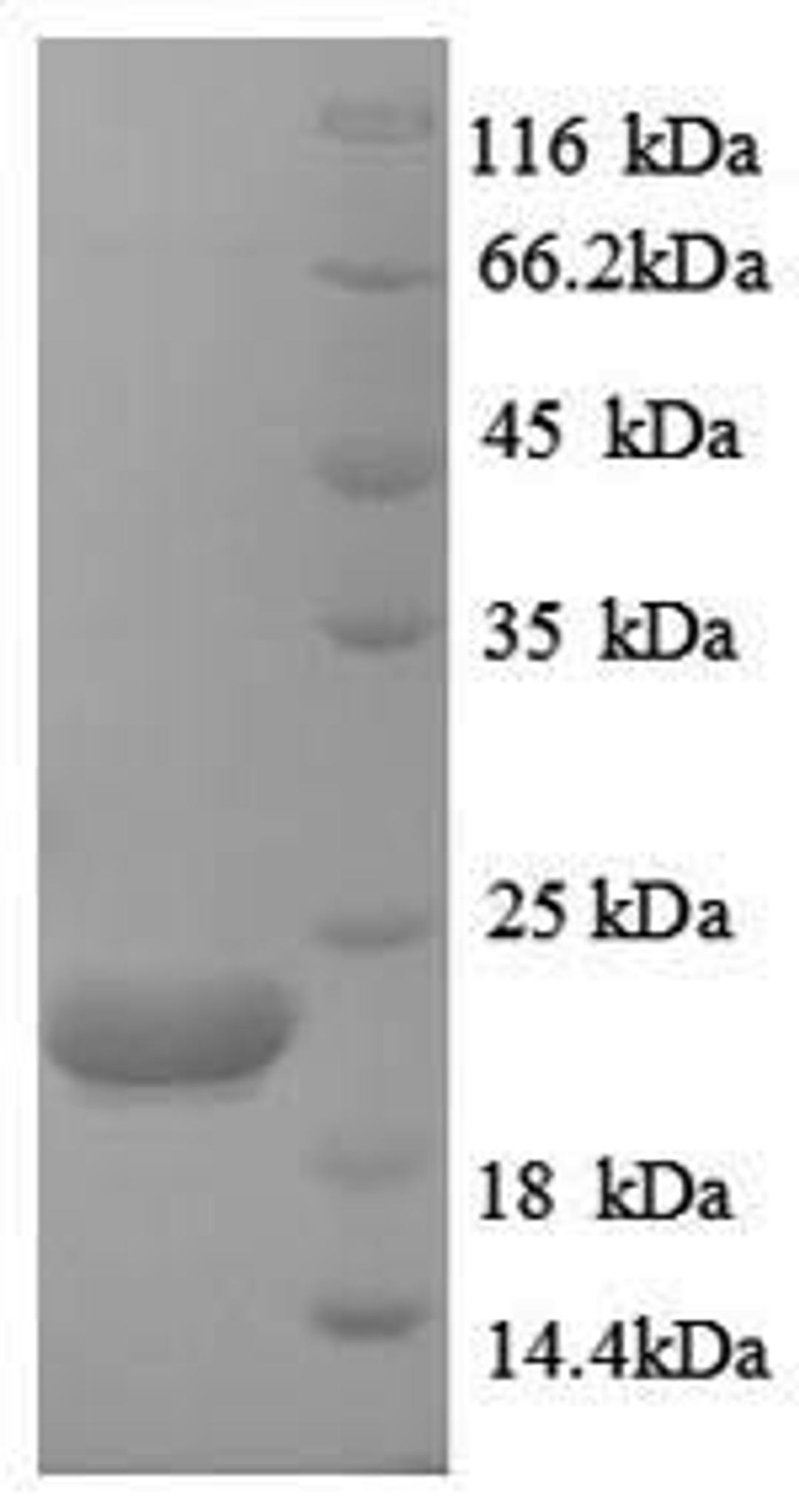 (Tris-Glycine gel) Discontinuous SDS-PAGE (reduced) with 5% enrichment gel and 15% separation gel.