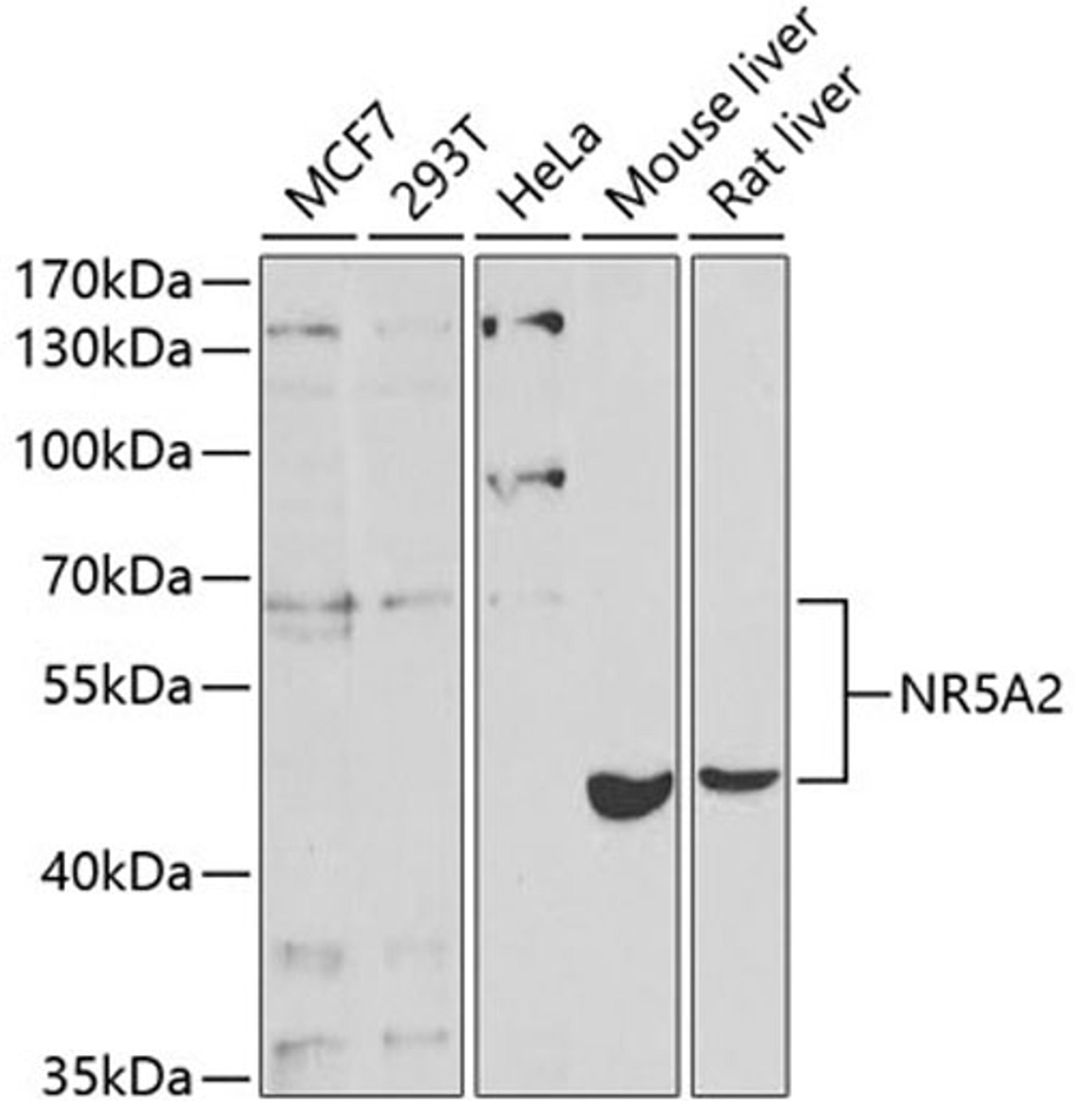 Western blot - NR5A2 antibody (A5766)