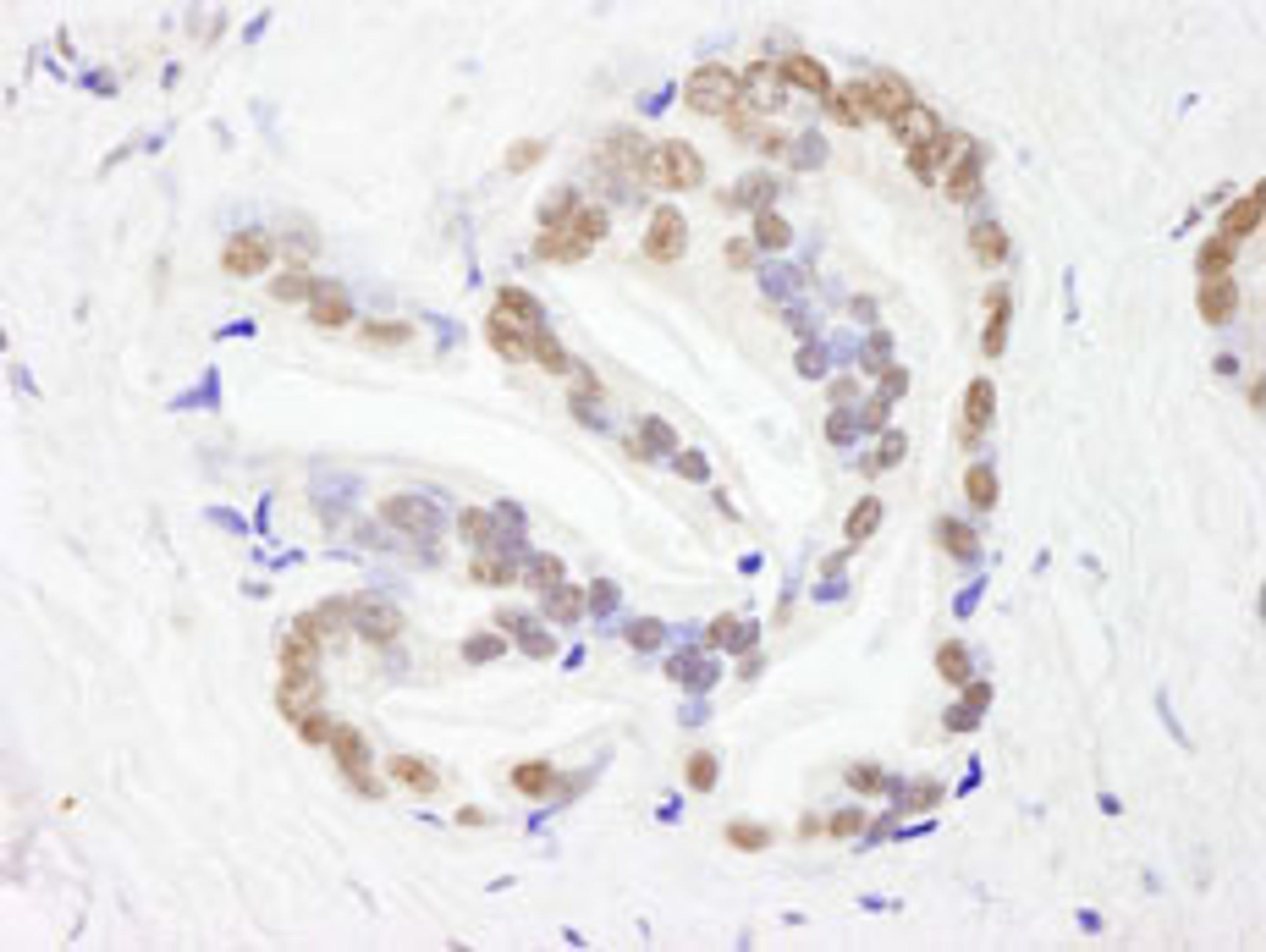 Detection of human RBM26 by immunohistochemistry.