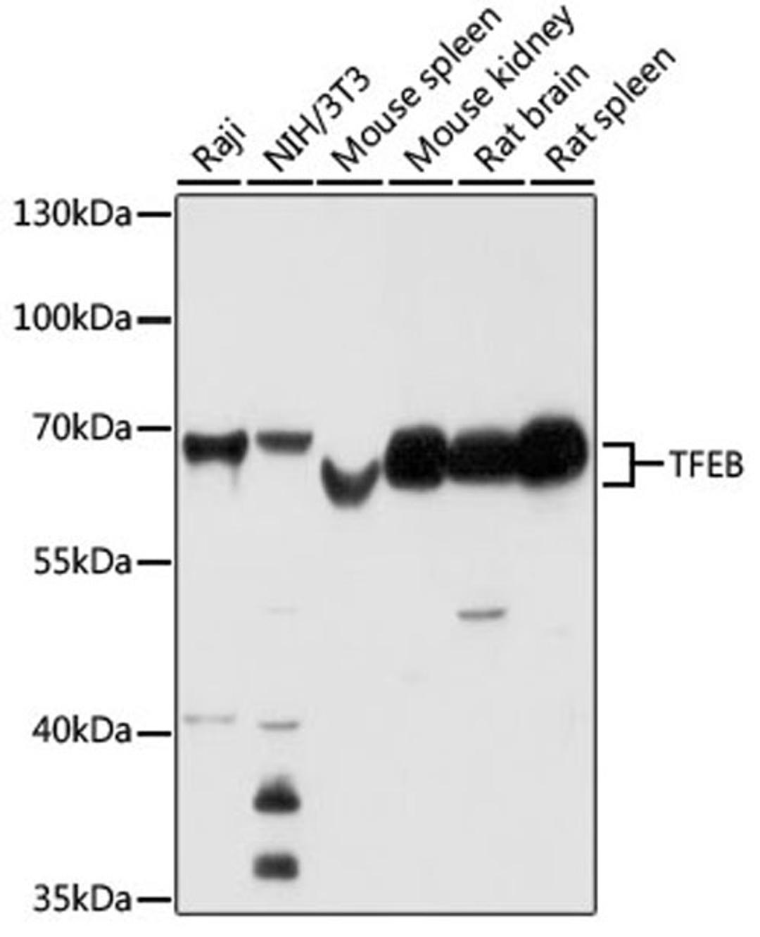 Western blot - TFEB antibody (A7311)