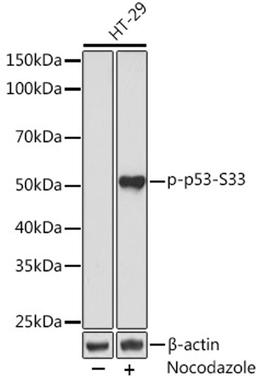 Western blot - Phospho-p53-S33 Rabbit mAb (AP0984)