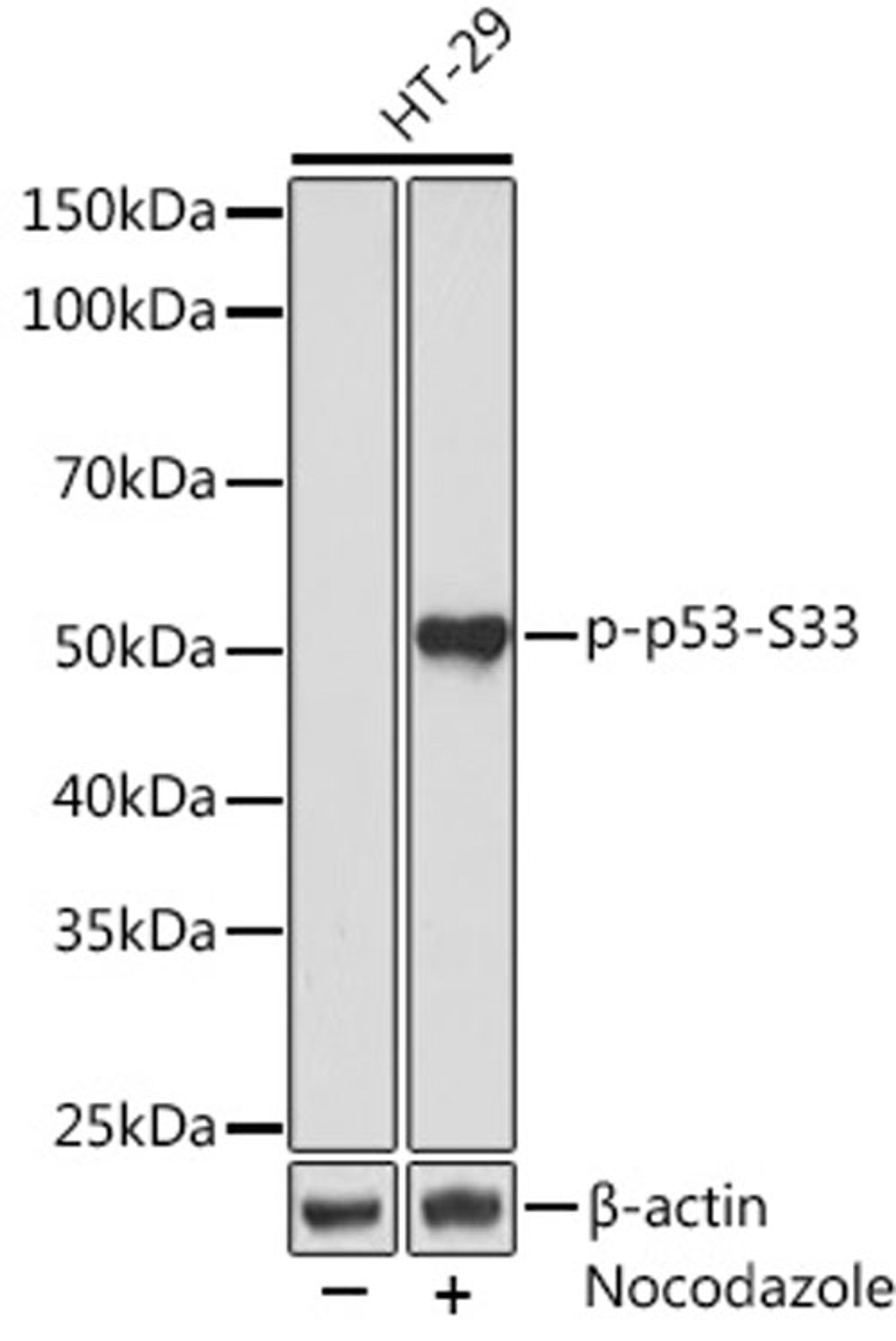 Western blot - Phospho-p53-S33 Rabbit mAb (AP0984)