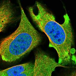 Immunocytochemistry/Immunofluorescence: Protein Kinase D3 Antibody [NBP1-87948] Staining of human cell line U-2 OS shows positivity in nucleus but not nucleoli & cytoplasm.