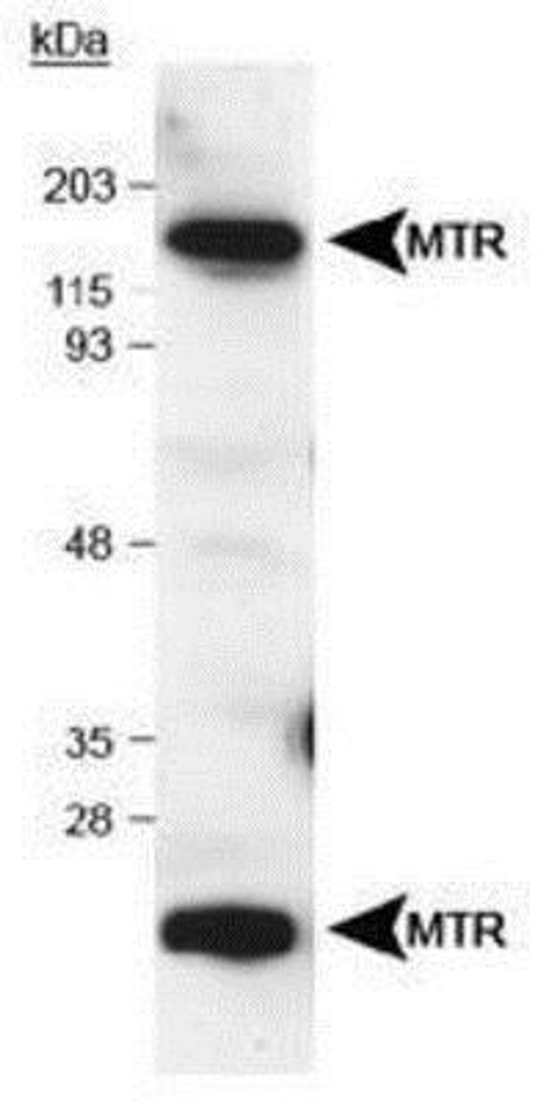 Western Blot: MTR Antibody [NB100-791] - (2ug/ml) staining of Hela lysate (RIPA buffer, 1.4E5 cells per lane). Detected by western blot using chemiluminescence.