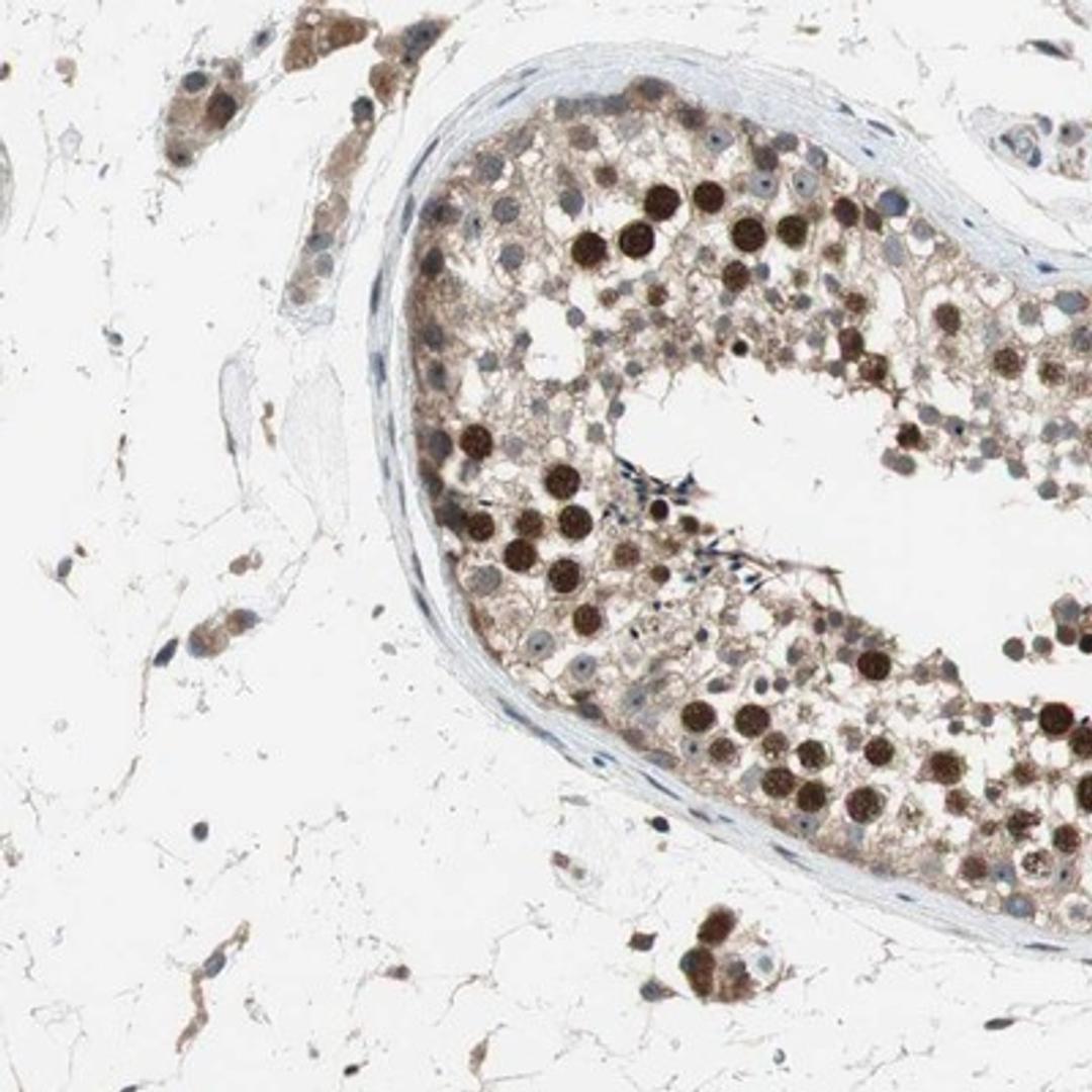 Immunohistochemistry-Paraffin: A-Myb Antibody [NBP1-90171] Staining of human testis shows strong nuclear positivity in cells in seminiferus ducts.