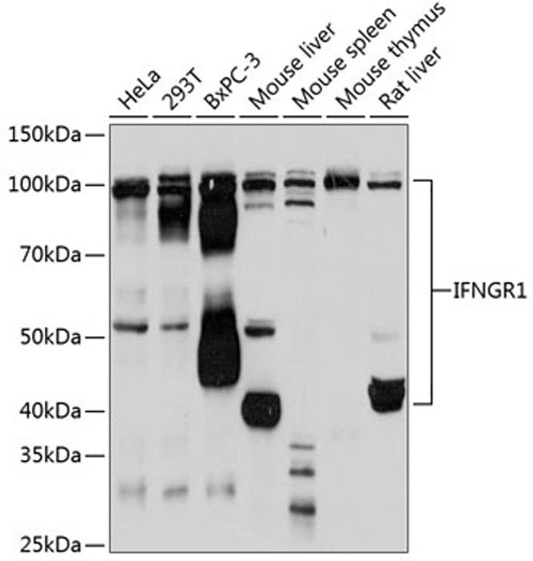 Western blot - IFNGR1 Rabbit mAb (A11653)