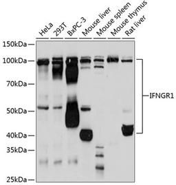 Western blot - IFNGR1 Rabbit mAb (A11653)