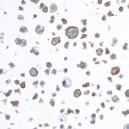 Detection of human LAG3 by immunocytochemistry.