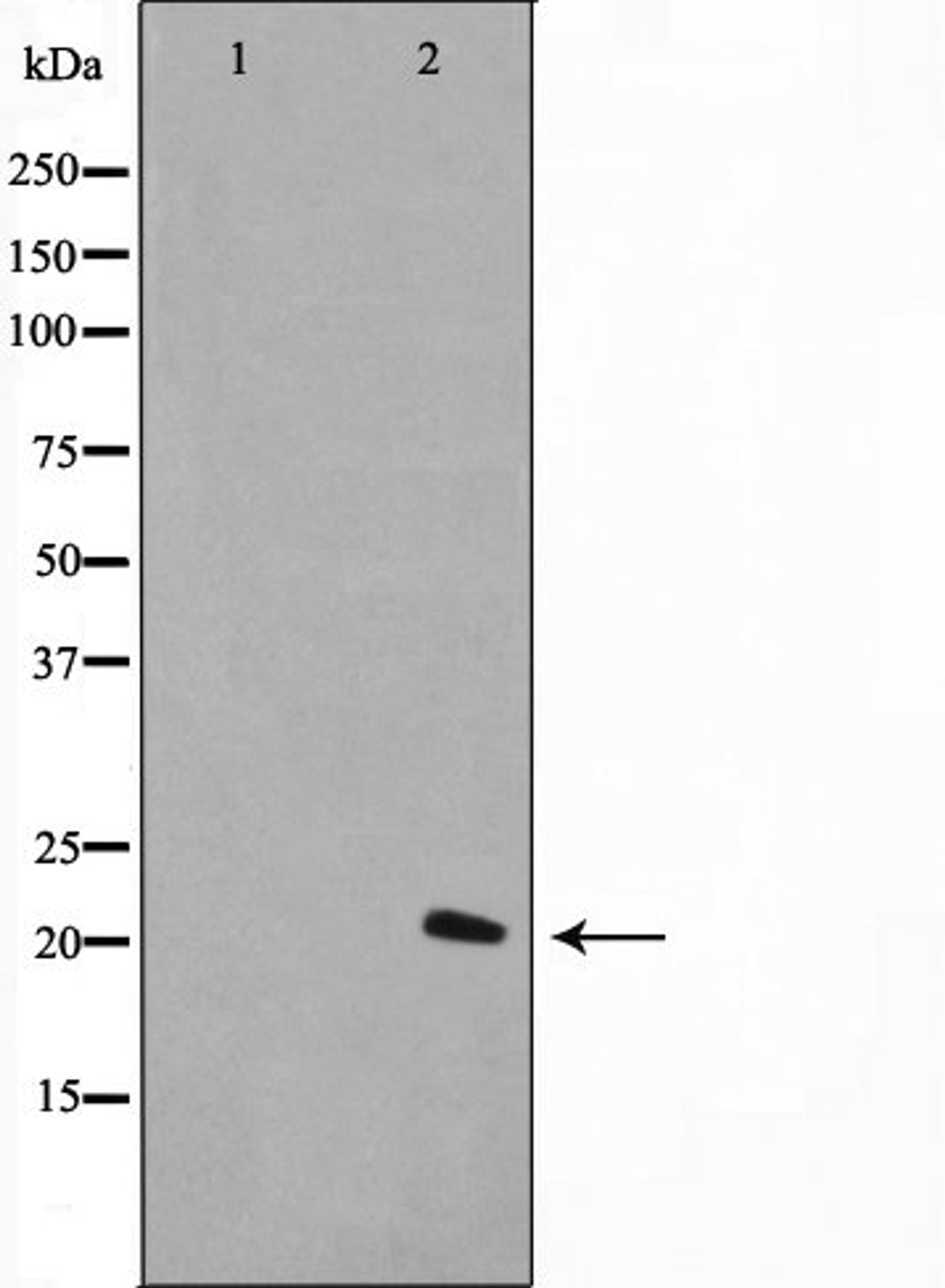 Western blot analysis of A549 cell lysate using Histone H1.0 antibody