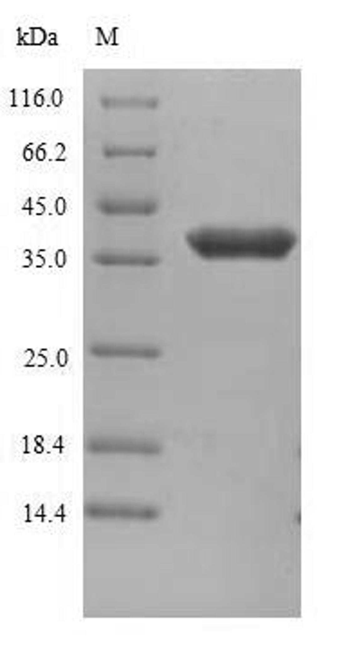 (Tris-Glycine gel) Discontinuous SDS-PAGE (reduced) with 5% enrichment gel and 15% separation gel.