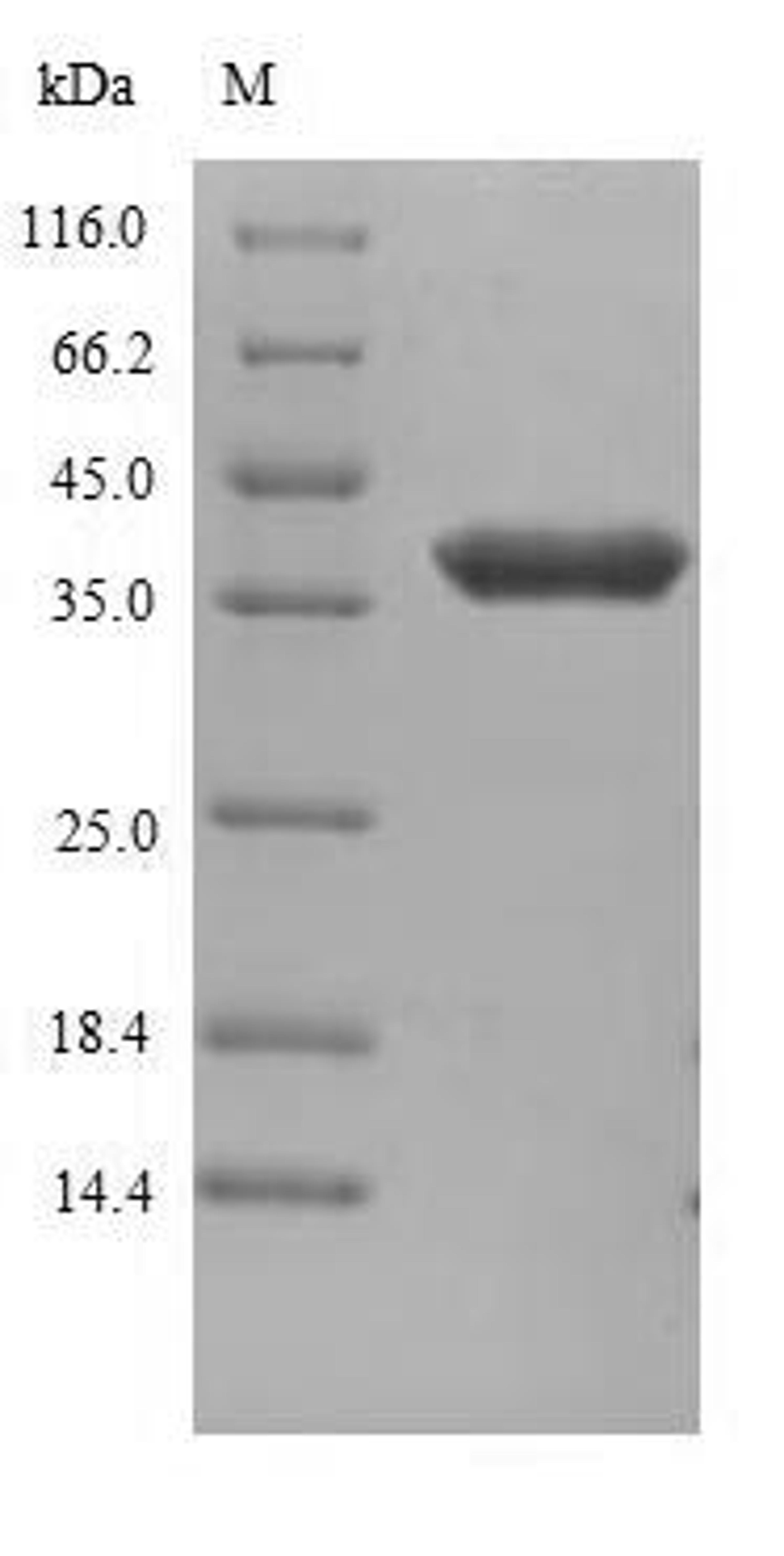 (Tris-Glycine gel) Discontinuous SDS-PAGE (reduced) with 5% enrichment gel and 15% separation gel.
