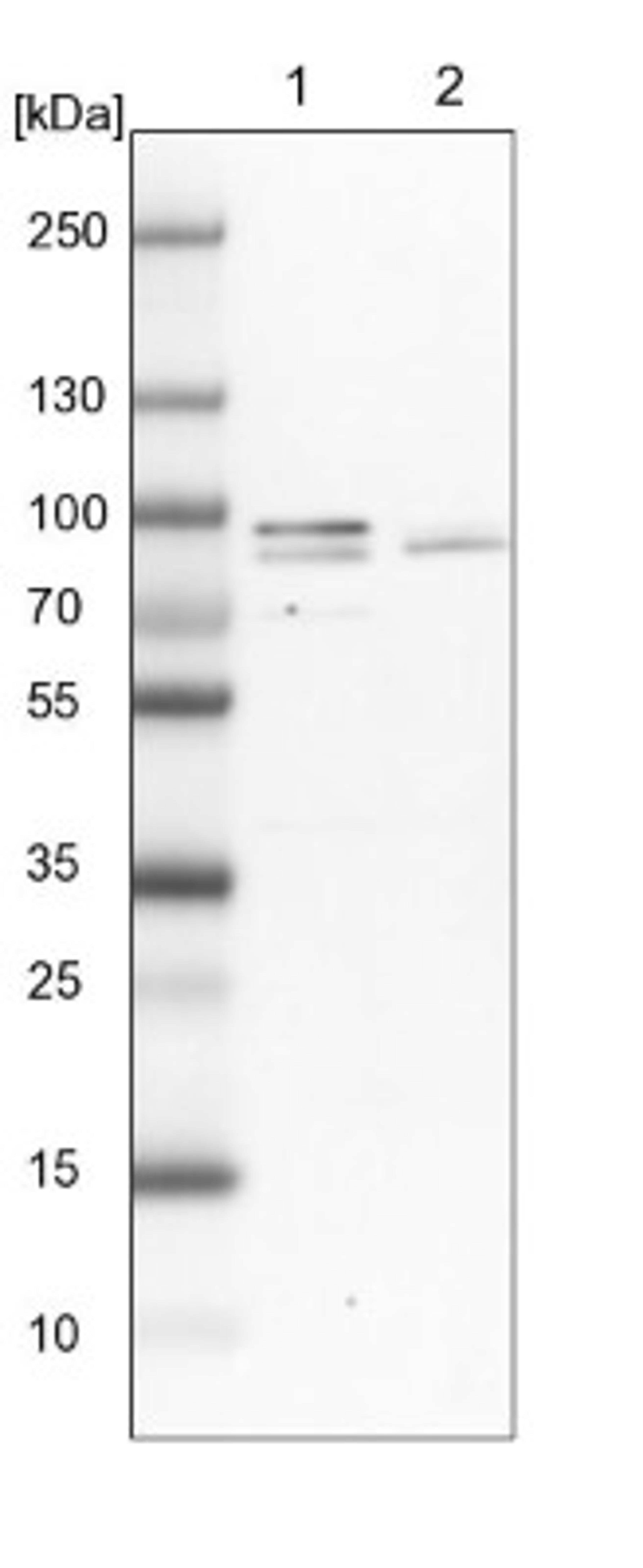 Western Blot: KLHL14 Antibody [NBP1-81413] - Lane 1: NIH-3T3 cell lysate (Mouse embryonic fibroblast cells)<br/>Lane 2: NBT-II cell lysate (Rat Wistar bladder tumour cells)