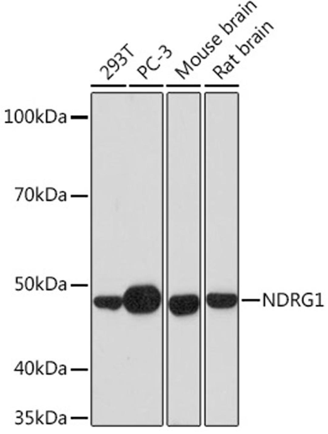 Western blot - NDRG1 Rabbit mAb (A4050)