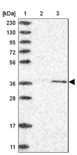 Immunohistochemistry: CDK20 Antibody [NBP1-91214] - Lane 1: Marker [kDa] 230, 130, 95, 72, 56, 36, 28, 17, 11<br/>Lane 2: Human cell line RT-4<br/>Lane 3: Human cell line U-251MG sp