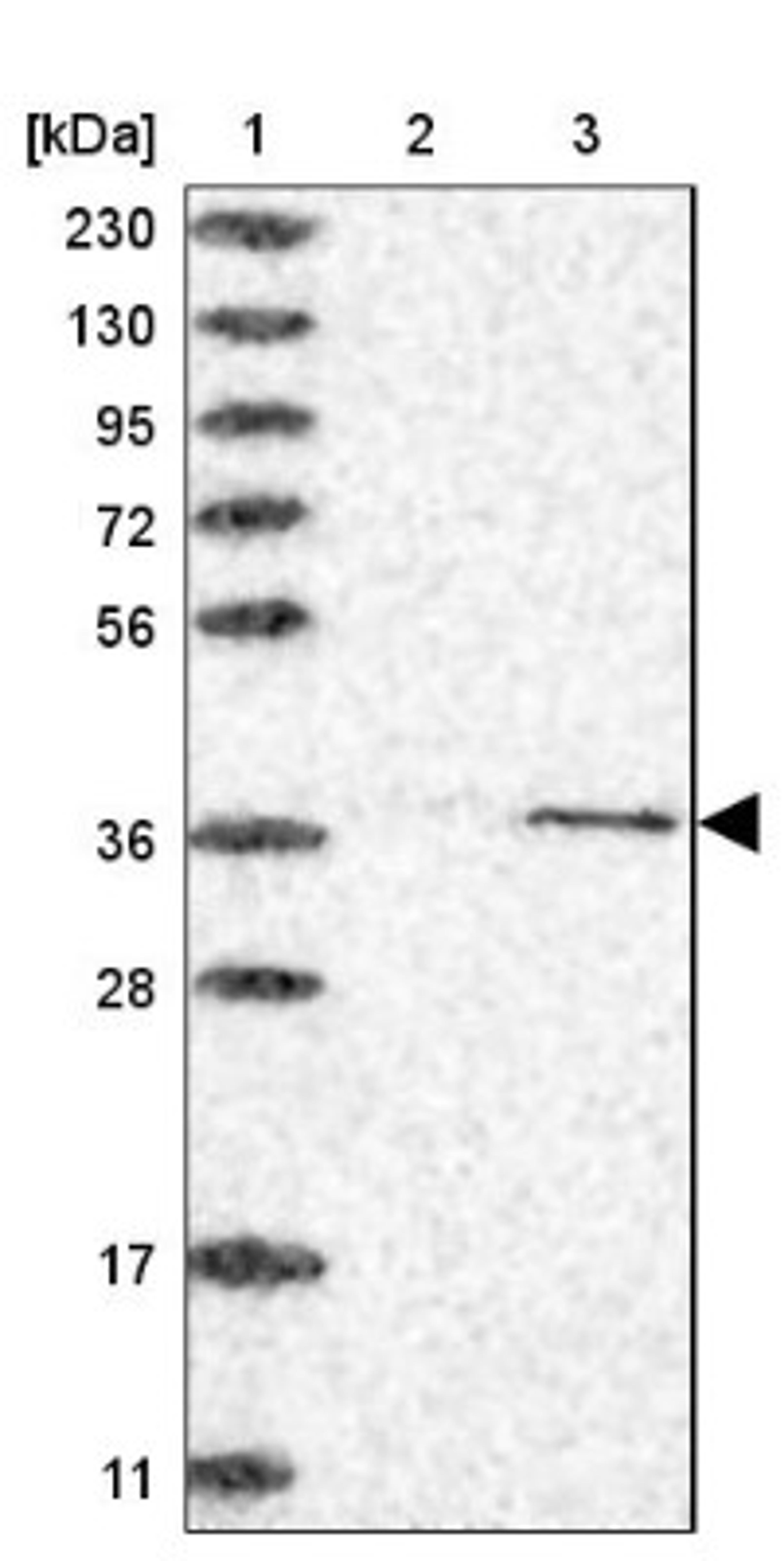 Immunohistochemistry: CDK20 Antibody [NBP1-91214] - Lane 1: Marker [kDa] 230, 130, 95, 72, 56, 36, 28, 17, 11<br/>Lane 2: Human cell line RT-4<br/>Lane 3: Human cell line U-251MG sp