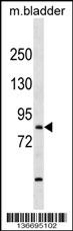 Western blot analysis in mouse bladder tissue lysates (35ug/lane).