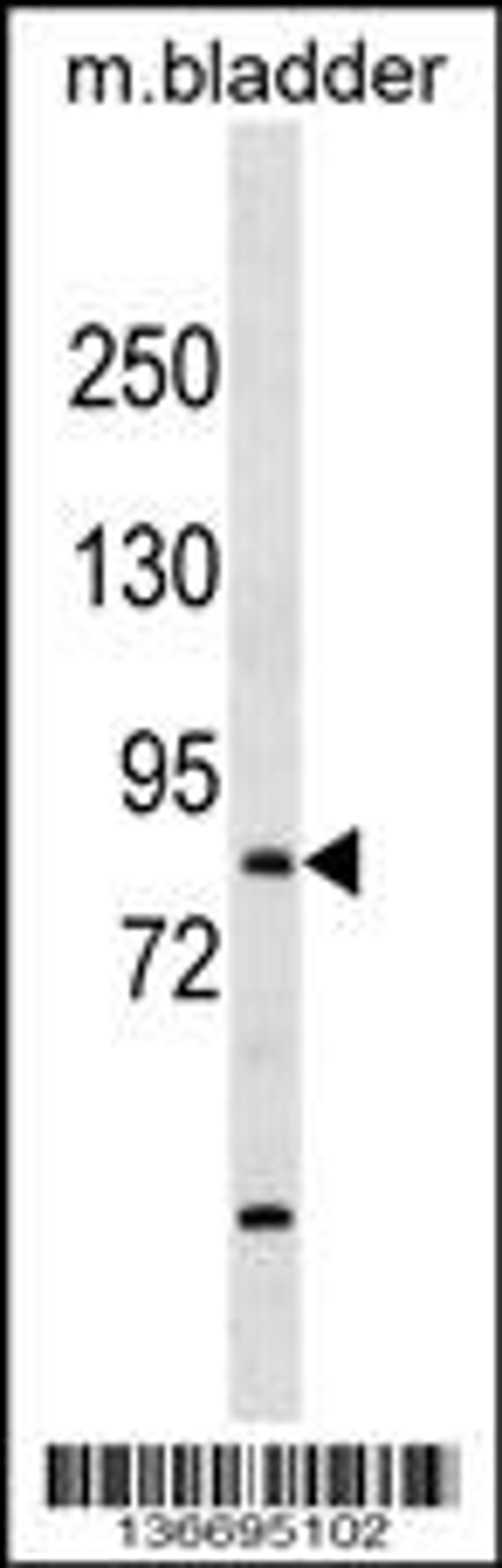 Western blot analysis in mouse bladder tissue lysates (35ug/lane).