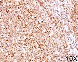 IHC testing of human tonsil (10X) stained with CD79a antibody (HM47/A9).