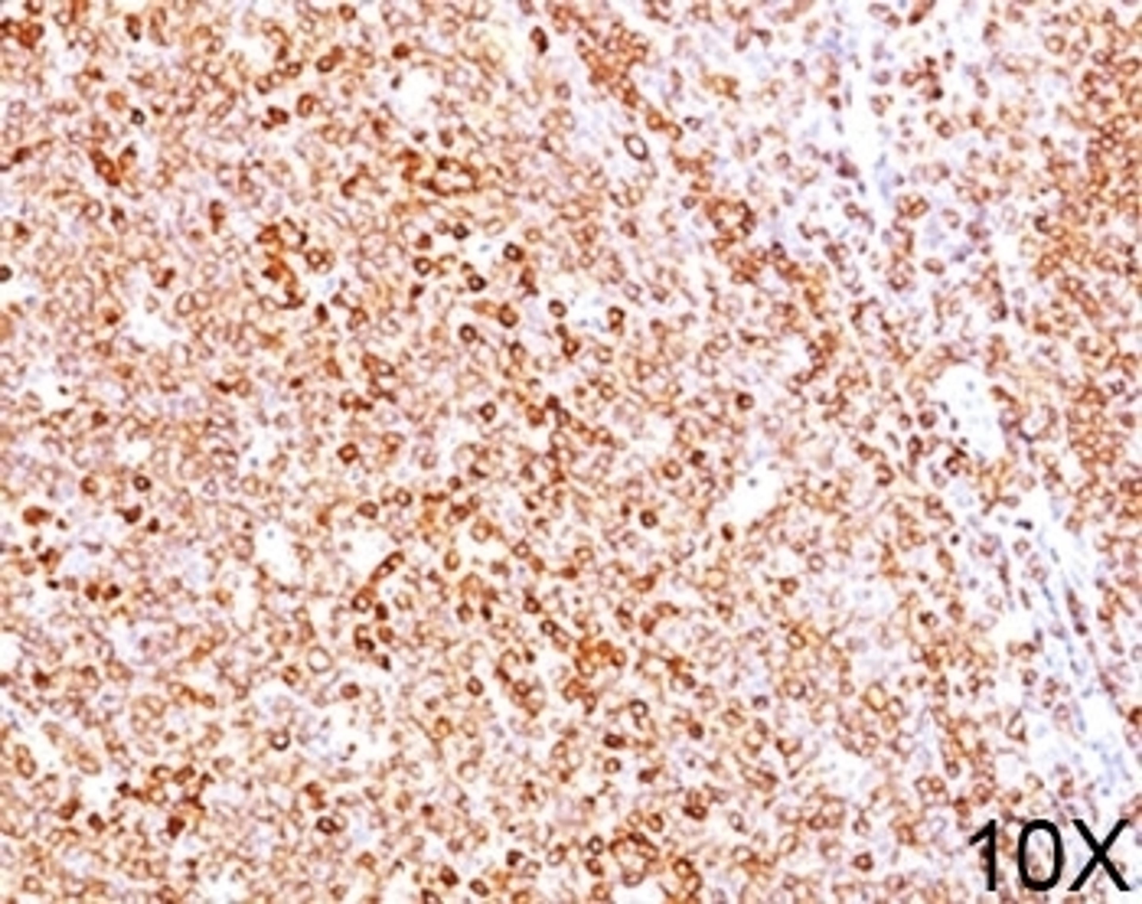 IHC testing of human tonsil (10X) stained with CD79a antibody (HM47/A9).