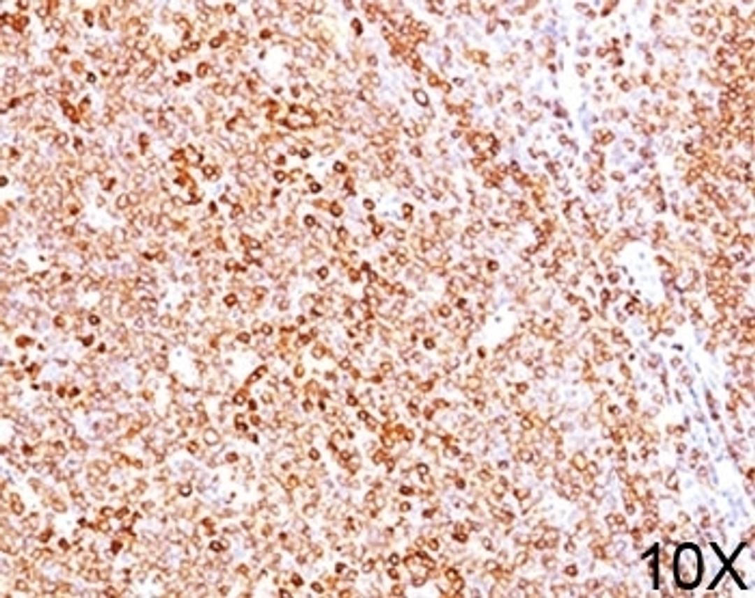 IHC testing of human tonsil (10X) stained with CD79a antibody (HM47/A9).
