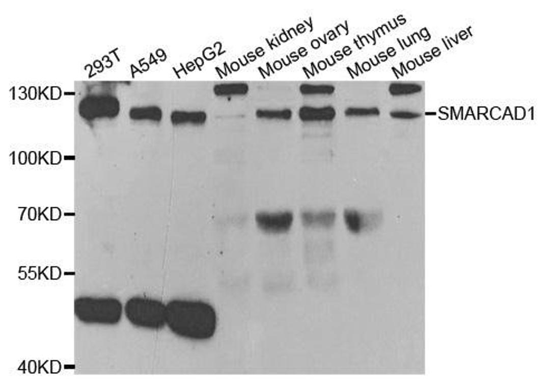 Western blot analysis of extracts of various cell lines using SMARCAD1 antibody