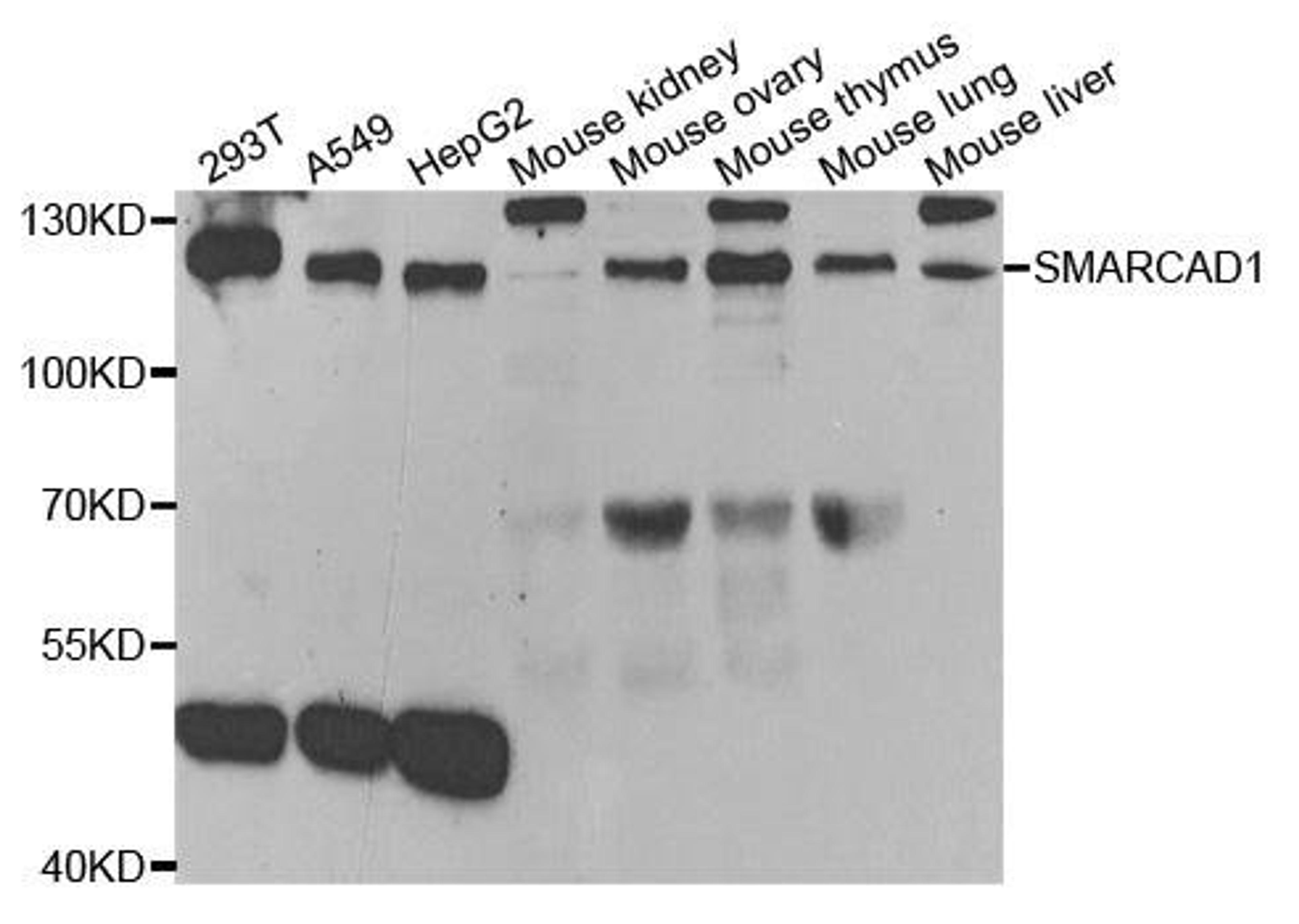 Western blot analysis of extracts of various cell lines using SMARCAD1 antibody