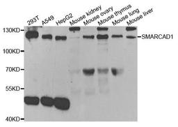 Western blot analysis of extracts of various cell lines using SMARCAD1 antibody