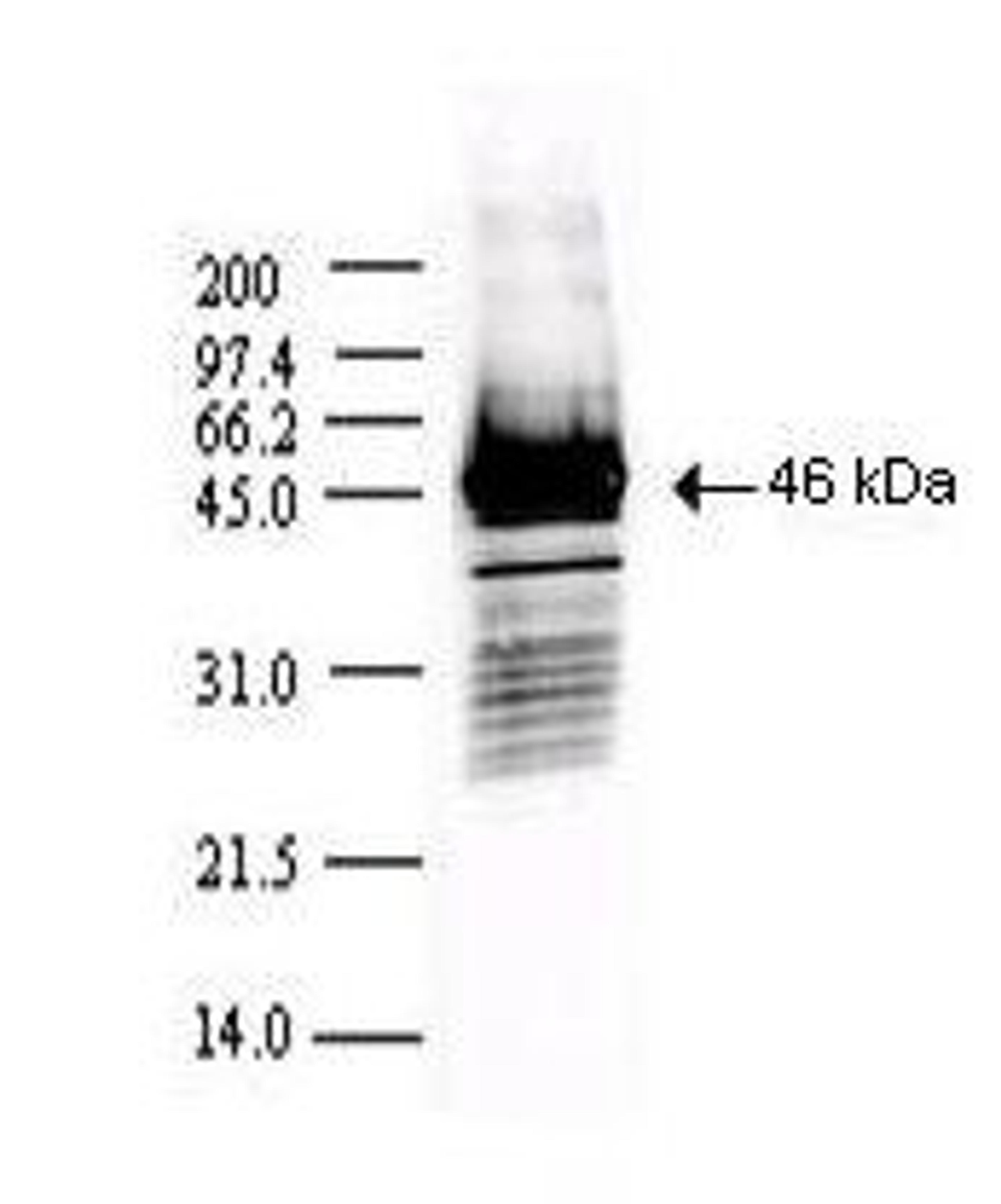 Western blot analysis of detection of a 46-kDa band corresponding to the protein using Sars Nucleocapsid Protein antibody