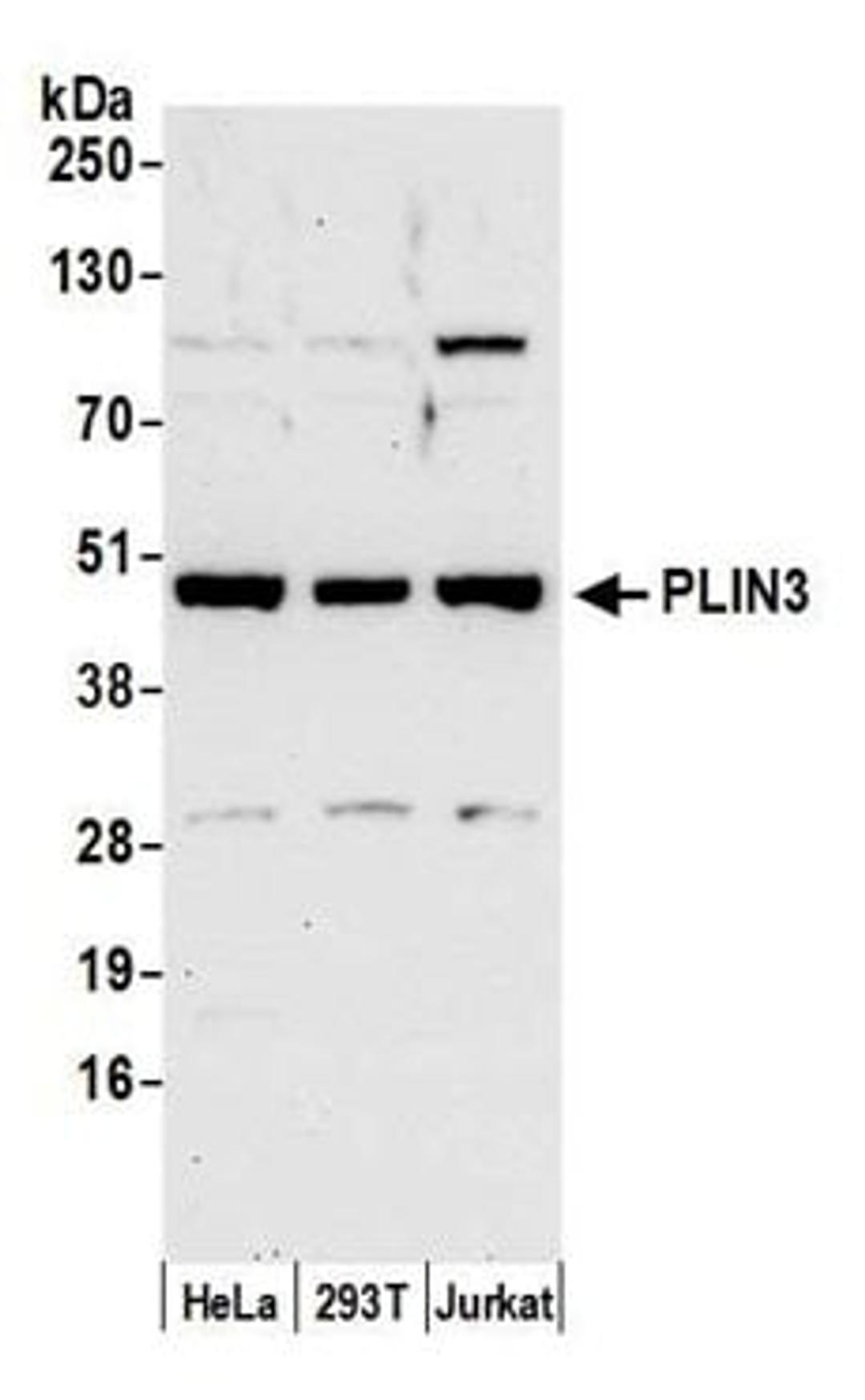 Detection of human PLIN3 by western blot.