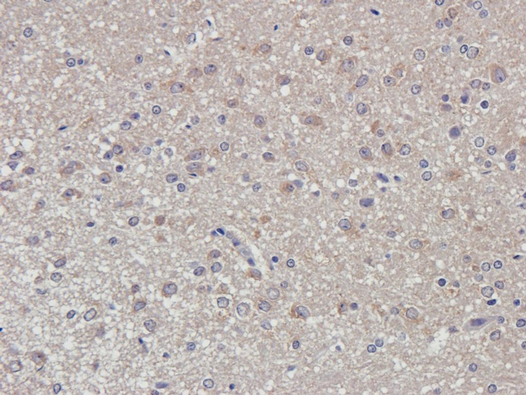 Immunohistochemical staining of rat brain tissue using Dopamine D2 receptor antibody (2.5 ug/ml)